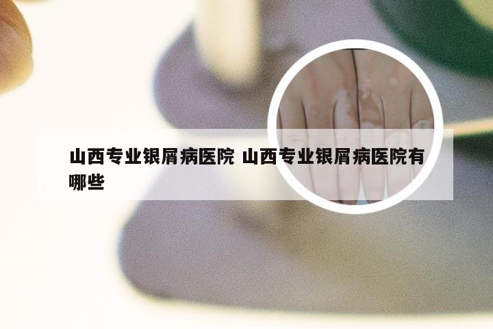 山西专业银屑病医院 山西专业银屑病医院有哪些
