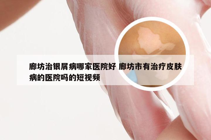 廊坊治银屑病哪家医院好 廊坊市有治疗皮肤病的医院吗的短视频