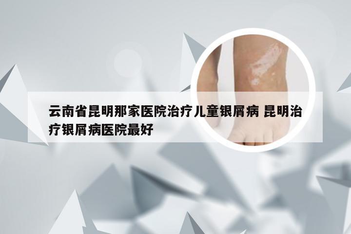 云南省昆明那家医院治疗儿童银屑病 昆明治疗银屑病医院最好