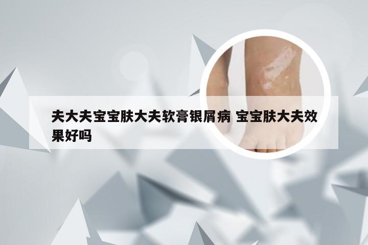 夫大夫宝宝肤大夫软膏银屑病 宝宝肤大夫效果好吗