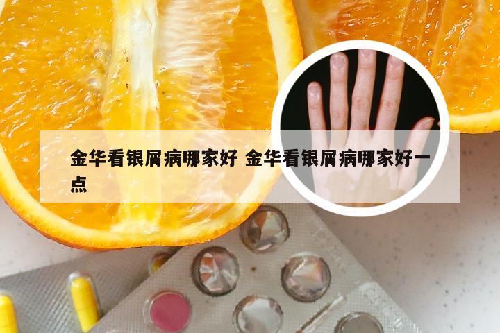 金华看银屑病哪家好 金华看银屑病哪家好一点