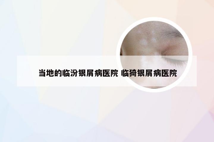 当地的临汾银屑病医院 临猗银屑病医院