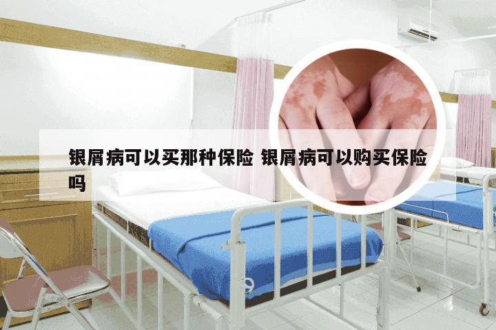 银屑病可以买那种保险 银屑病可以购买保险吗