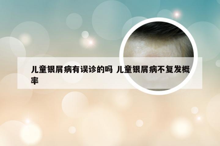 儿童银屑病有误诊的吗 儿童银屑病不复发概率