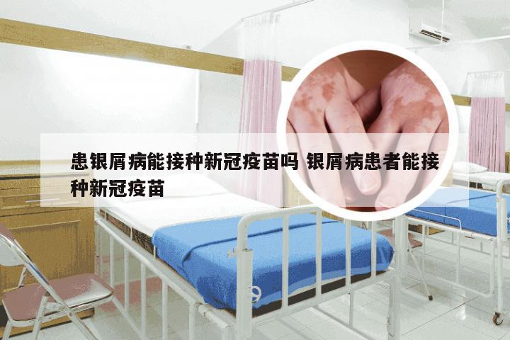 患银屑病能接种新冠疫苗吗 银屑病患者能接种新冠疫苗