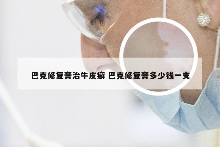 巴克修复膏治牛皮癣 巴克修复膏多少钱一支