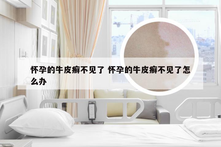 怀孕的牛皮癣不见了 怀孕的牛皮癣不见了怎么办