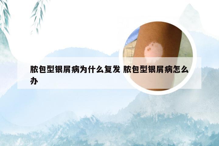 脓包型银屑病为什么复发 脓包型银屑病怎么办