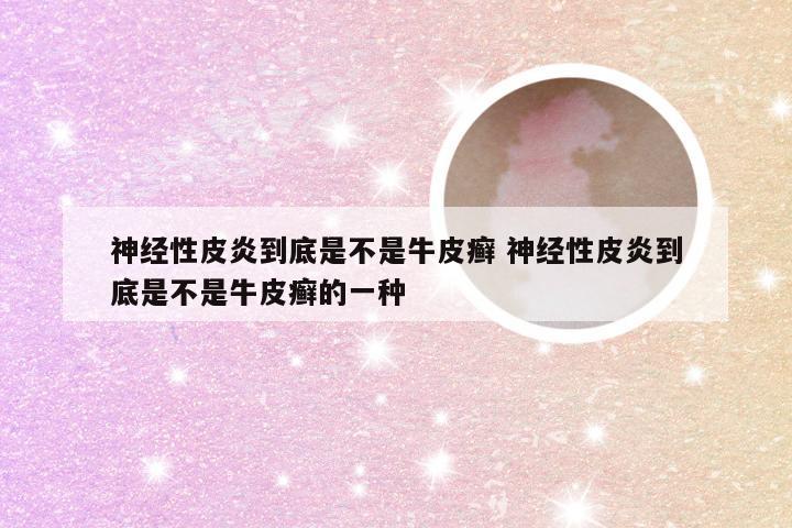 神经性皮炎到底是不是牛皮癣 神经性皮炎到底是不是牛皮癣的一种