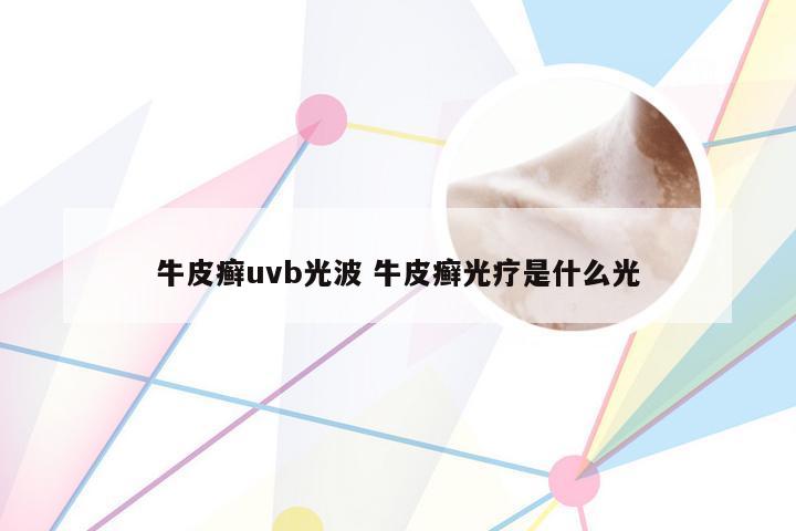 牛皮癣uvb光波 牛皮癣光疗是什么光