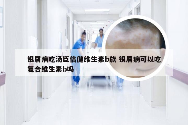银屑病吃汤臣倍健维生素b族 银屑病可以吃复合维生素b吗