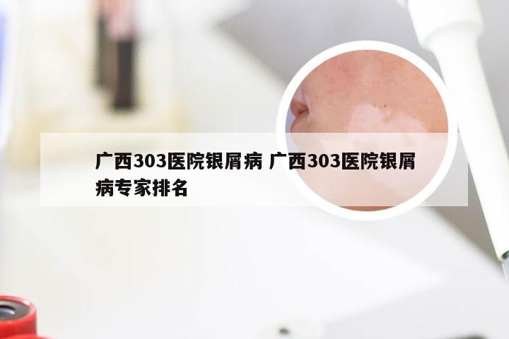 广西303医院银屑病 广西303医院银屑病专家排名