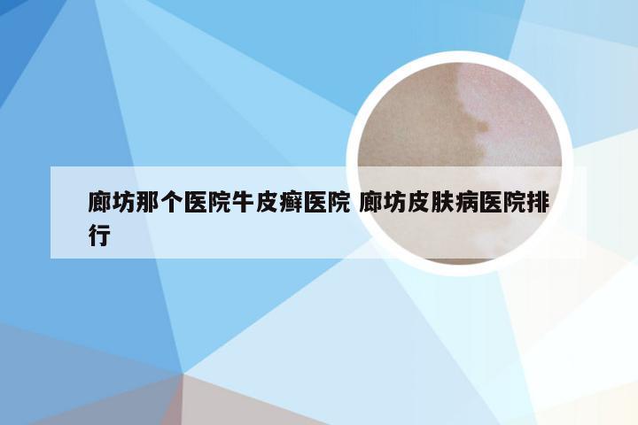 廊坊那个医院牛皮癣医院 廊坊皮肤病医院排行