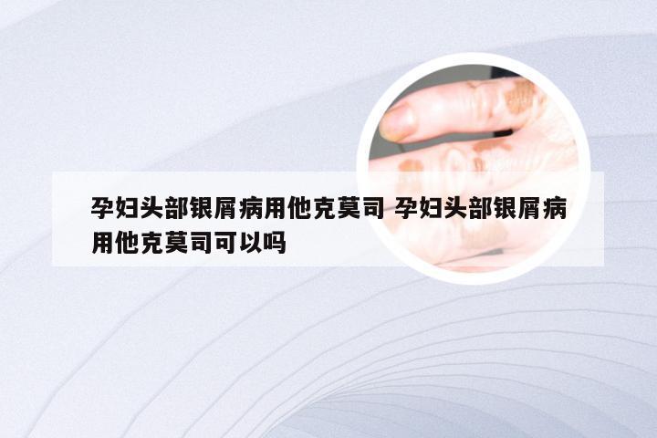 孕妇头部银屑病用他克莫司 孕妇头部银屑病用他克莫司可以吗