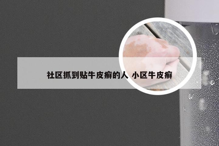 社区抓到贴牛皮癣的人 小区牛皮癣
