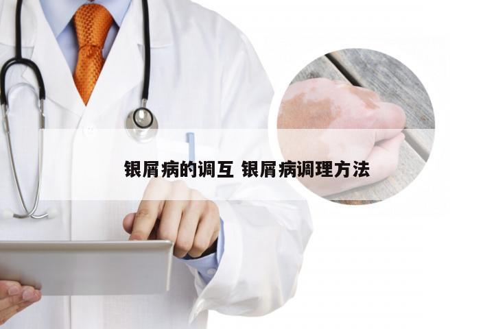 银屑病的调互 银屑病调理方法