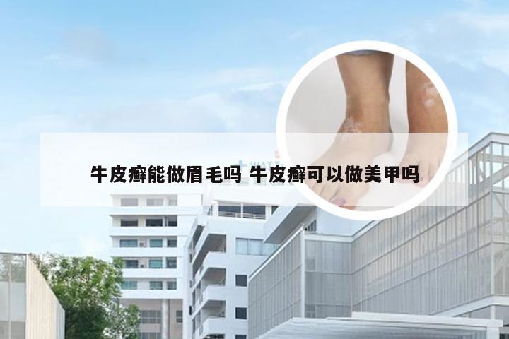 牛皮癣能做眉毛吗 牛皮癣可以做美甲吗