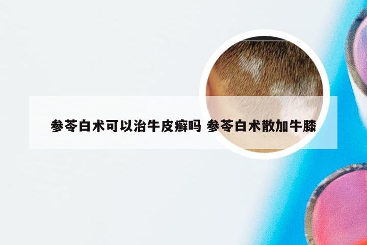 参苓白术可以治牛皮癣吗 参苓白术散加牛膝