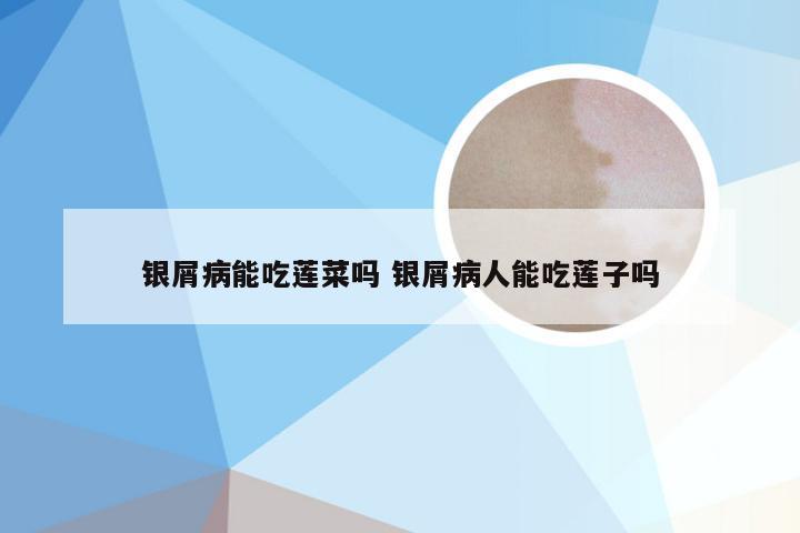 银屑病能吃莲菜吗 银屑病人能吃莲子吗