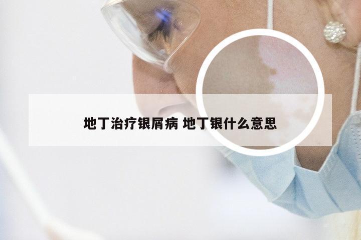 地丁治疗银屑病 地丁银什么意思