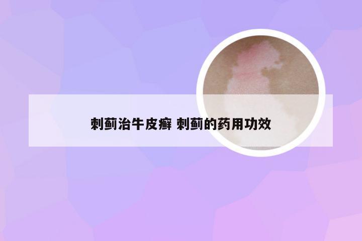 刺蓟治牛皮癣 刺蓟的药用功效