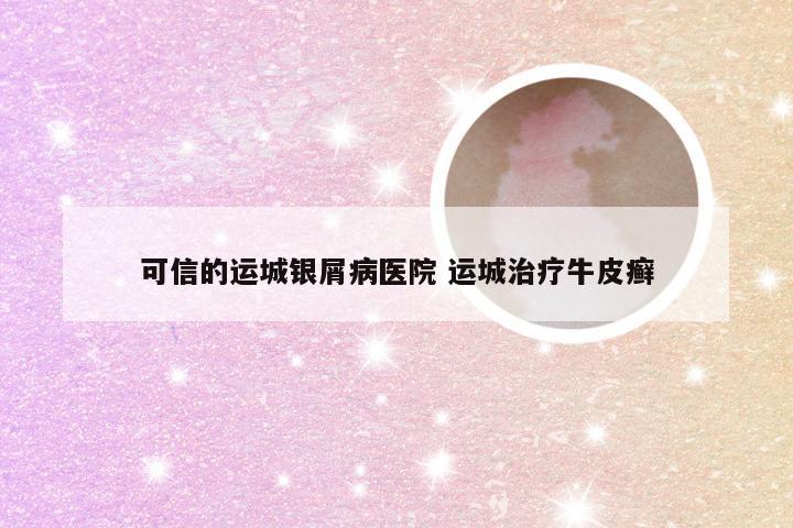 可信的运城银屑病医院 运城治疗牛皮癣