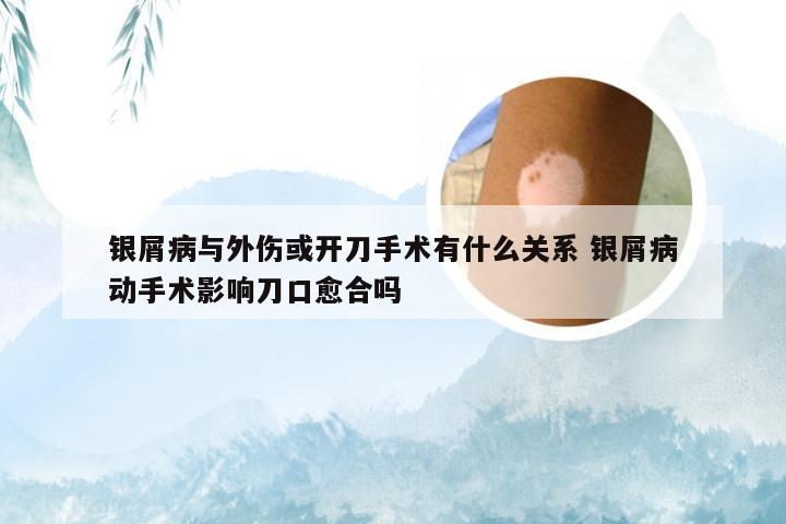 银屑病与外伤或开刀手术有什么关系 银屑病动手术影响刀口愈合吗