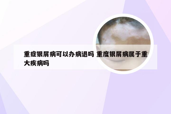 重症银屑病可以办病退吗 重度银屑病属于重大疾病吗