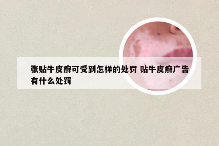 张贴牛皮癣可受到怎样的处罚 贴牛皮癣广告有什么处罚