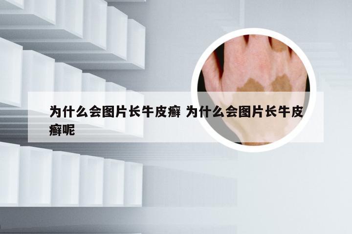 为什么会图片长牛皮癣 为什么会图片长牛皮癣呢