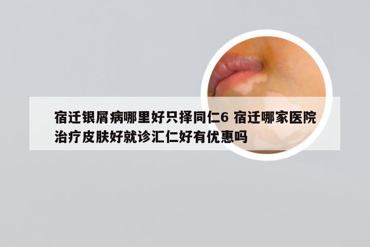 宿迁银屑病哪里好只择同仁6 宿迁哪家医院治疗皮肤好就诊汇仁好有优惠吗