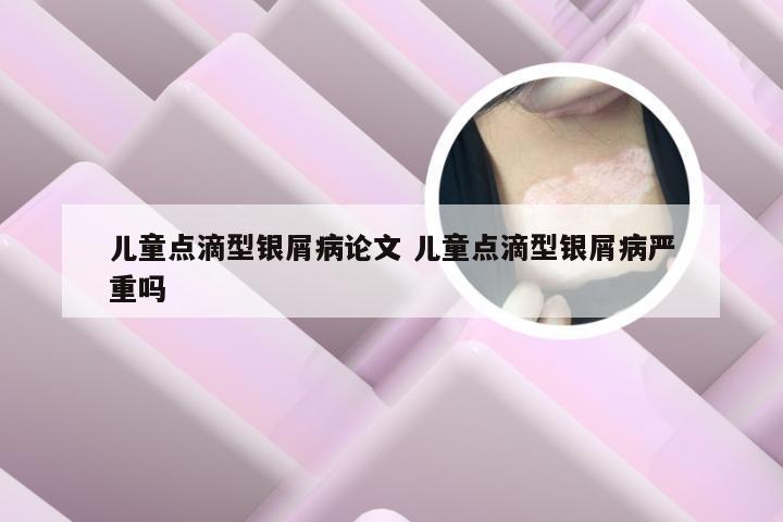 儿童点滴型银屑病论文 儿童点滴型银屑病严重吗
