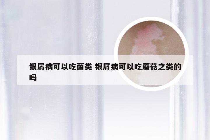 银屑病可以吃菌类 银屑病可以吃蘑菇之类的吗