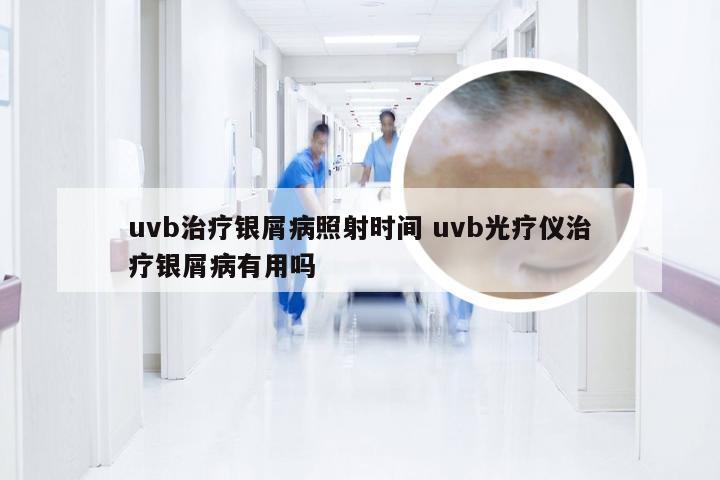 uvb治疗银屑病照射时间 uvb光疗仪治疗银屑病有用吗