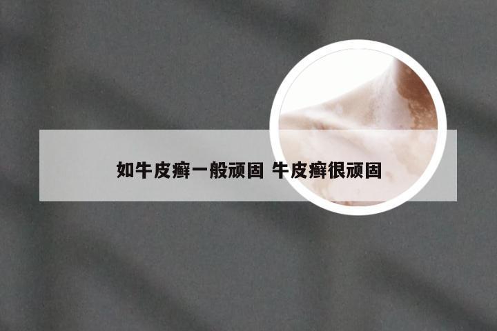 如牛皮癣一般顽固 牛皮癣很顽固