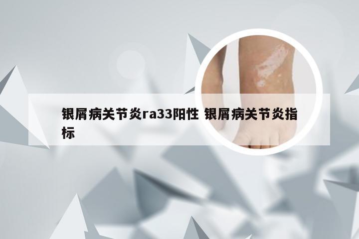 银屑病关节炎ra33阳性 银屑病关节炎指标