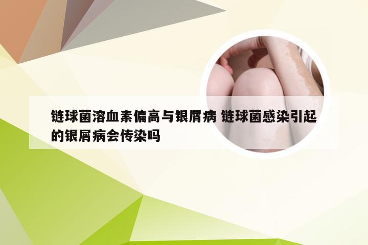 链球菌溶血素偏高与银屑病 链球菌感染引起的银屑病会传染吗