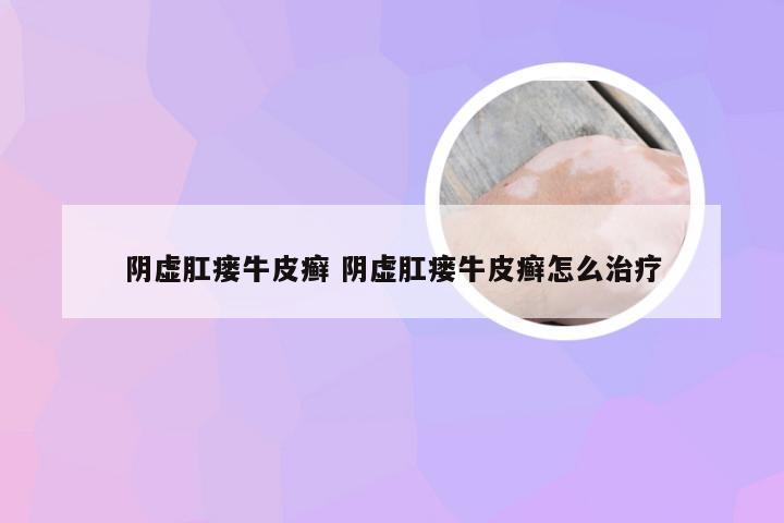 阴虚肛瘘牛皮癣 阴虚肛瘘牛皮癣怎么治疗