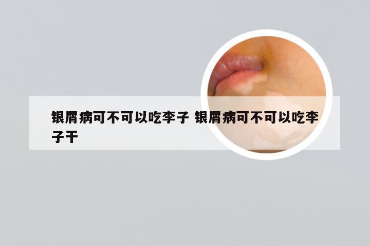 银屑病可不可以吃李子 银屑病可不可以吃李子干