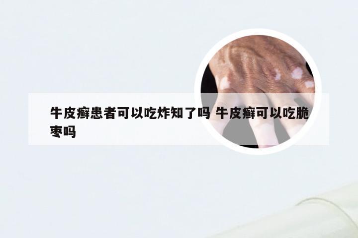 牛皮癣患者可以吃炸知了吗 牛皮癣可以吃脆枣吗