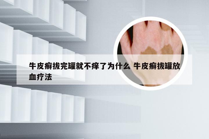 牛皮癣拔完罐就不痒了为什么 牛皮癣拔罐放血疗法