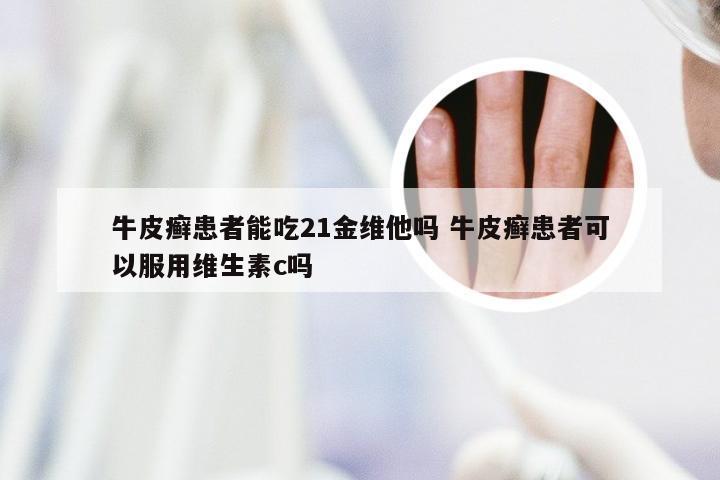 牛皮癣患者能吃21金维他吗 牛皮癣患者可以服用维生素c吗