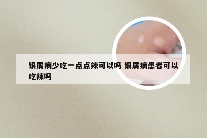 银屑病少吃一点点辣可以吗 银屑病患者可以吃辣吗