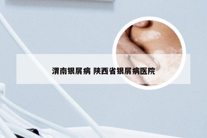 渭南银屑病 陕西省银屑病医院