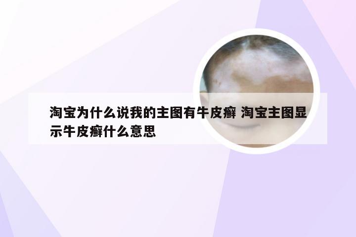 淘宝为什么说我的主图有牛皮癣 淘宝主图显示牛皮癣什么意思