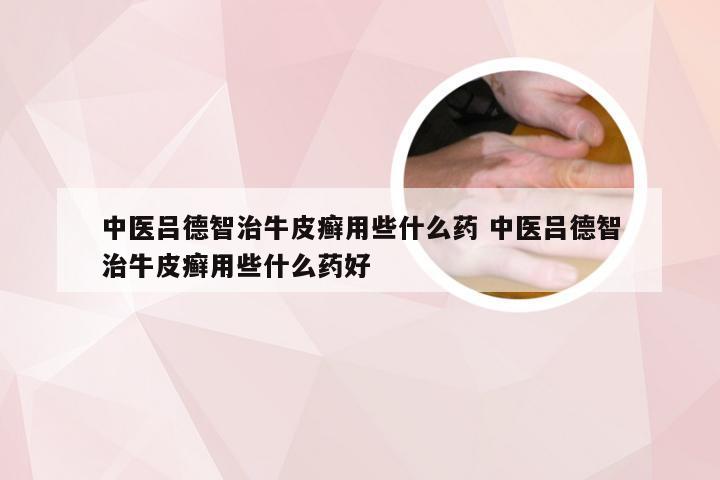 中医吕德智治牛皮癣用些什么药 中医吕德智治牛皮癣用些什么药好