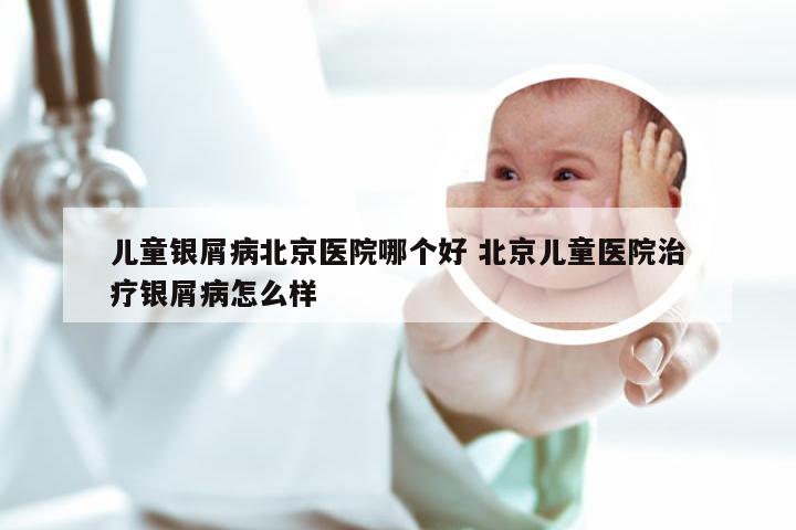儿童银屑病北京医院哪个好 北京儿童医院治疗银屑病怎么样