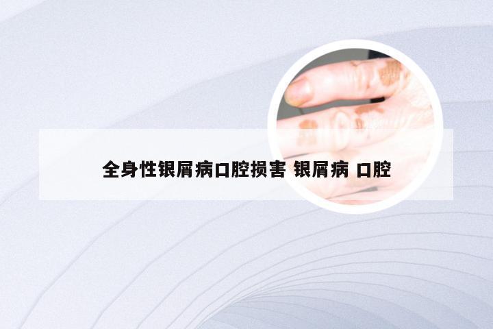 全身性银屑病口腔损害 银屑病 口腔