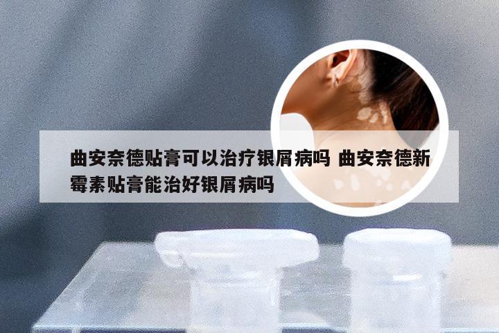 曲安奈德贴膏可以治疗银屑病吗 曲安奈德新霉素贴膏能治好银屑病吗