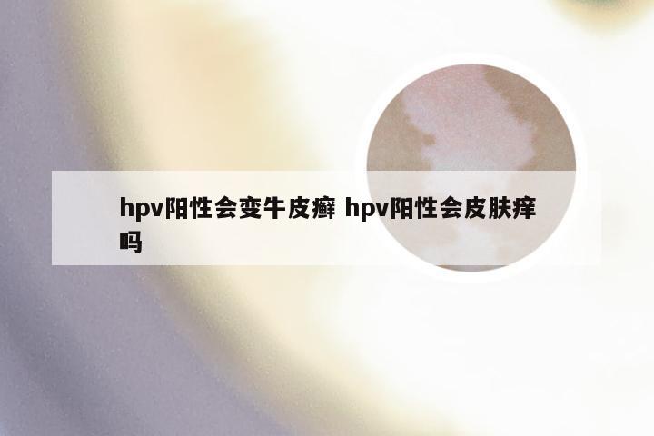 hpv阳性会变牛皮癣 hpv阳性会皮肤痒吗